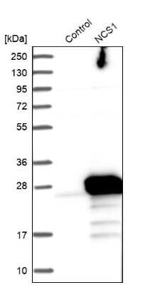 Western Blot: Frequenin Antibody [NBP1-89820]