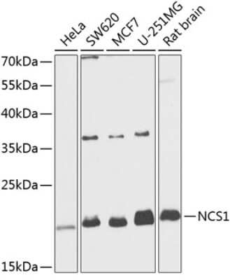 Western Blot: Frequenin AntibodyBSA Free [NBP3-03316]