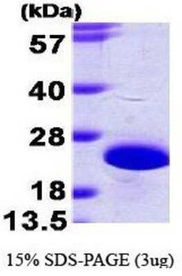 SDS-PAGE: Recombinant Human Frequenin His Protein [NBP1-44484]