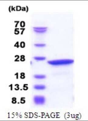 SDS-PAGE: Recombinant Human Frequenin His Protein [NBP2-51819]