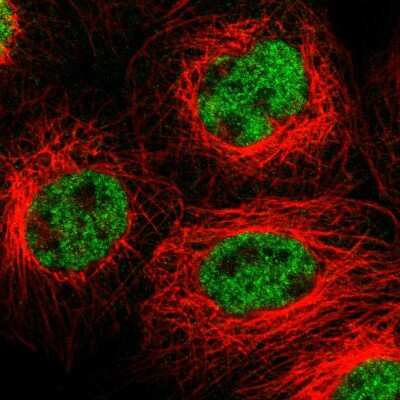 Immunocytochemistry/ Immunofluorescence: Frizzled-10 Antibody [NBP1-85753]