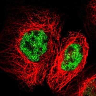 Immunocytochemistry/ Immunofluorescence: Frizzled-10 Antibody [NBP1-85754]