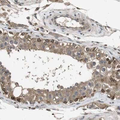Immunohistochemistry-Paraffin: Frizzled-10 Antibody [NBP1-85753]
