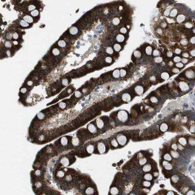 Immunohistochemistry-Paraffin: Frizzled-10 Antibody [NBP1-85754]
