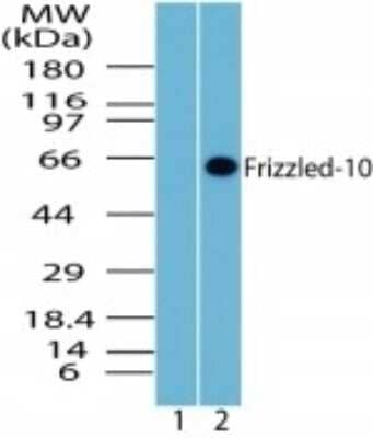 Western Blot: Frizzled-10 Antibody [NBP2-23659]