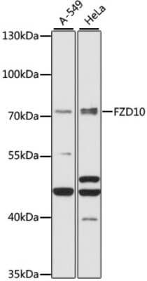 Western Blot: Frizzled-10 AntibodyAzide and BSA Free [NBP3-03466]