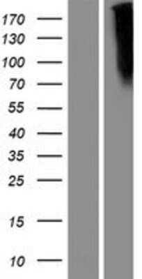 Western Blot: Frizzled-10 Overexpression Lysate [NBP2-10379]