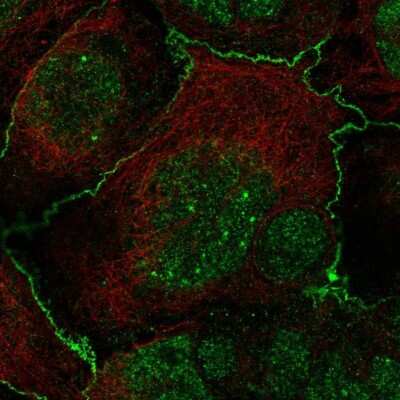 Immunocytochemistry/ Immunofluorescence: Frizzled-2 Antibody [NBP2-33842]