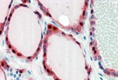 Immunohistochemistry-Paraffin: Frizzled-2 Antibody [NBP1-20920]