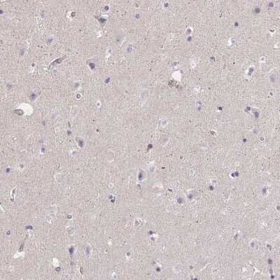 Immunohistochemistry-Paraffin: Frizzled-2 Antibody [NBP2-33842]