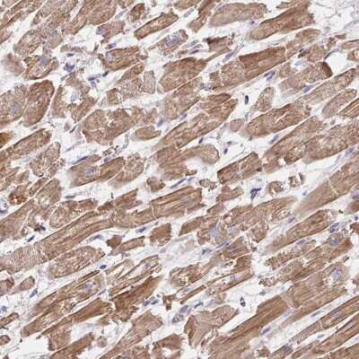 Immunohistochemistry-Paraffin: Frizzled-2 Antibody [NBP2-33842]