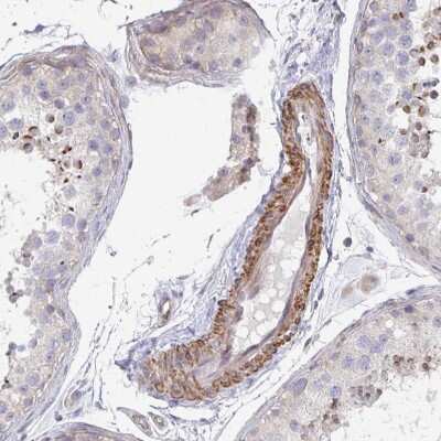 Immunohistochemistry-Paraffin: Frizzled-2 Antibody [NBP2-33842]