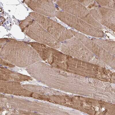Immunohistochemistry-Paraffin: Frizzled-2 Antibody [NBP2-33842]