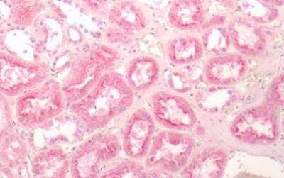 Immunohistochemistry-Paraffin: Frizzled-2 Antibody - BSA Free [NLS3488]