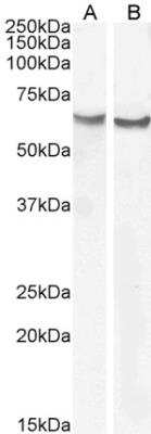 Western Blot: Frizzled-2 Antibody [NBP1-20920]