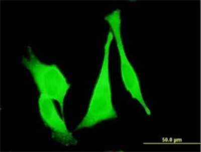 Immunocytochemistry/ Immunofluorescence: Frizzled-3 Antibody (2H5) [H00007976-M09]