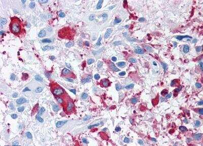 Immunohistochemistry-Paraffin: Frizzled-3 Antibody - BSA Free [NLS4437]