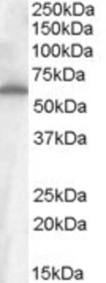 Western Blot: Frizzled-4 Antibody [NB100-93397]