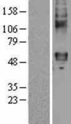 Western Blot: Frizzled-4 Overexpression Lysate [NBL1-10890]