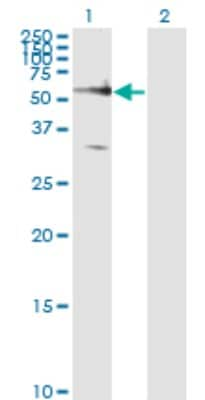 Western Blot: Frizzled-5 Antibody (6A3) [H00007855-M01]