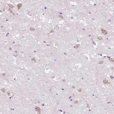 Immunohistochemistry-Paraffin: Frizzled-5 Antibody [NBP2-49040]