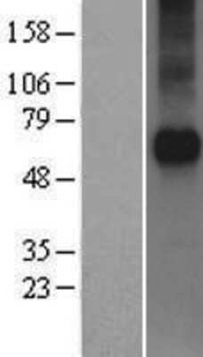 Western Blot: Frizzled-5 Overexpression Lysate [NBP2-04250]