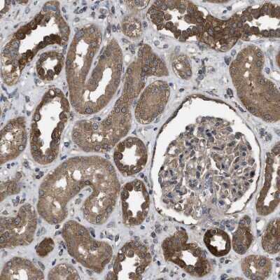 Immunohistochemistry-Paraffin: Frizzled-6 Antibody [NBP1-89702]