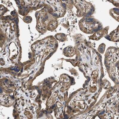 Immunohistochemistry-Paraffin: Frizzled-6 Antibody [NBP1-89702]