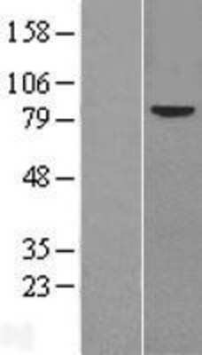 Western Blot: Frizzled-6 Overexpression Lysate [NBL1-10892]