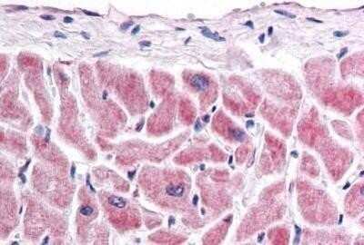 Immunohistochemistry-Paraffin: Frizzled-7 Antibody - BSA Free [NBP1-02320]