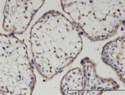 Immunohistochemistry-Paraffin: Frizzled-7 Antibody (4D9) [H00008324-M03]