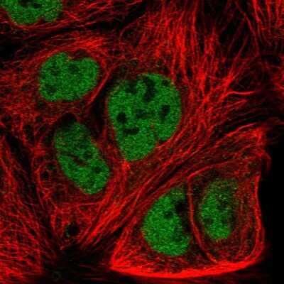 Immunocytochemistry/ Immunofluorescence: Frizzled-7 Antibody [NBP2-55952]