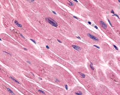 Immunohistochemistry-Paraffin: Frizzled-7 Antibody - BSA Free [NLS4900]