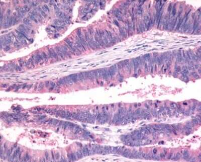 Immunohistochemistry-Paraffin: Frizzled-7 Antibody - BSA Free [NLS4900]