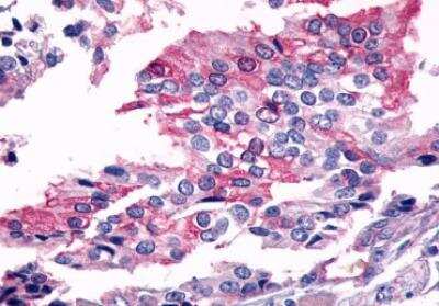 Immunohistochemistry-Paraffin: Frizzled-7 Antibody - BSA Free [NLS4900]