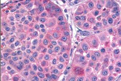 Immunohistochemistry-Paraffin: Frizzled-7 Antibody - BSA Free [NLS4900]