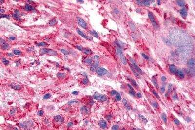 Immunohistochemistry-Paraffin: Frizzled-7 Antibody - BSA Free [NLS4900]