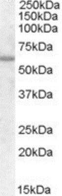 Western Blot: Frizzled-7 Antibody [NB100-93398]