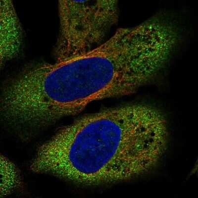 Immunocytochemistry/ Immunofluorescence: Frizzled-8 Antibody [NBP2-56913]