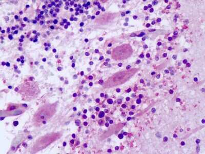 Immunohistochemistry-Paraffin: Frizzled-8 Antibody - BSA Free [NLS4767]