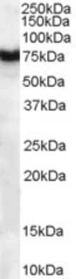 Western Blot: Frizzled-8 Antibody [NB100-2439]