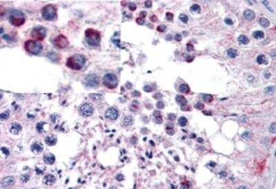 Immunohistochemistry-Paraffin: Frizzled-9 Antibody [NB100-94906]