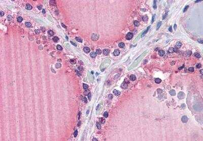 Immunohistochemistry-Paraffin: Frizzled-9 Antibody [NB100-94906]