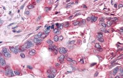 Immunohistochemistry-Paraffin: Frizzled-9 Antibody - BSA Free [NLS5097]