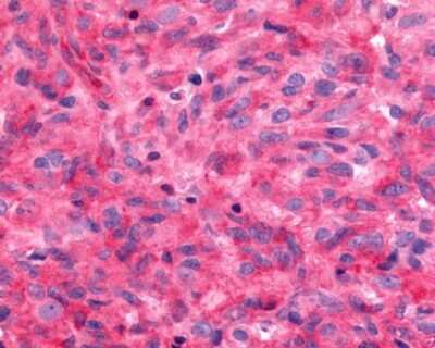 Immunohistochemistry-Paraffin: Frizzled-9 Antibody - BSA Free [NLS5103]