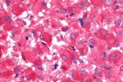 Immunohistochemistry-Paraffin: Frizzled-9 Antibody - BSA Free [NLS5103]