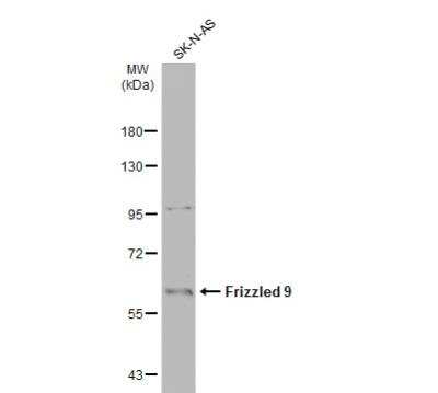 Western Blot: Frizzled-9 Antibody [NBP2-16533]