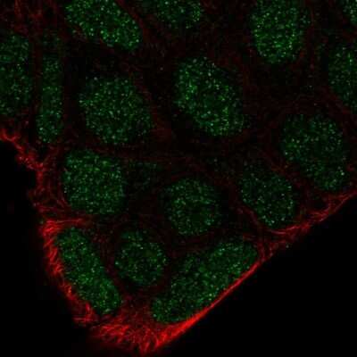 Immunocytochemistry/ Immunofluorescence: Frk Antibody [NBP2-68617]