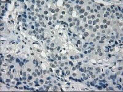 Immunohistochemistry: Frk Antibody (OTI6D2) - Azide and BSA Free [NBP2-70775]