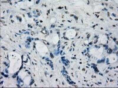 Immunohistochemistry: Frk Antibody (OTI6D2) - Azide and BSA Free [NBP2-70775]